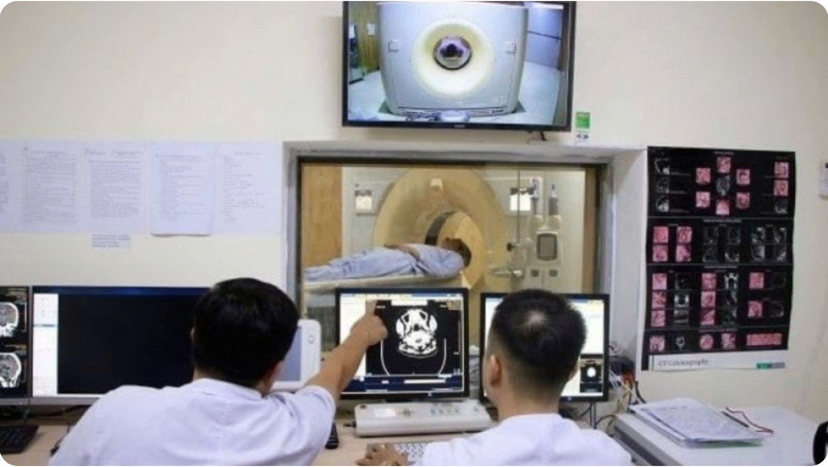 AI chẩn đoán hình ảnh X-quang tự động